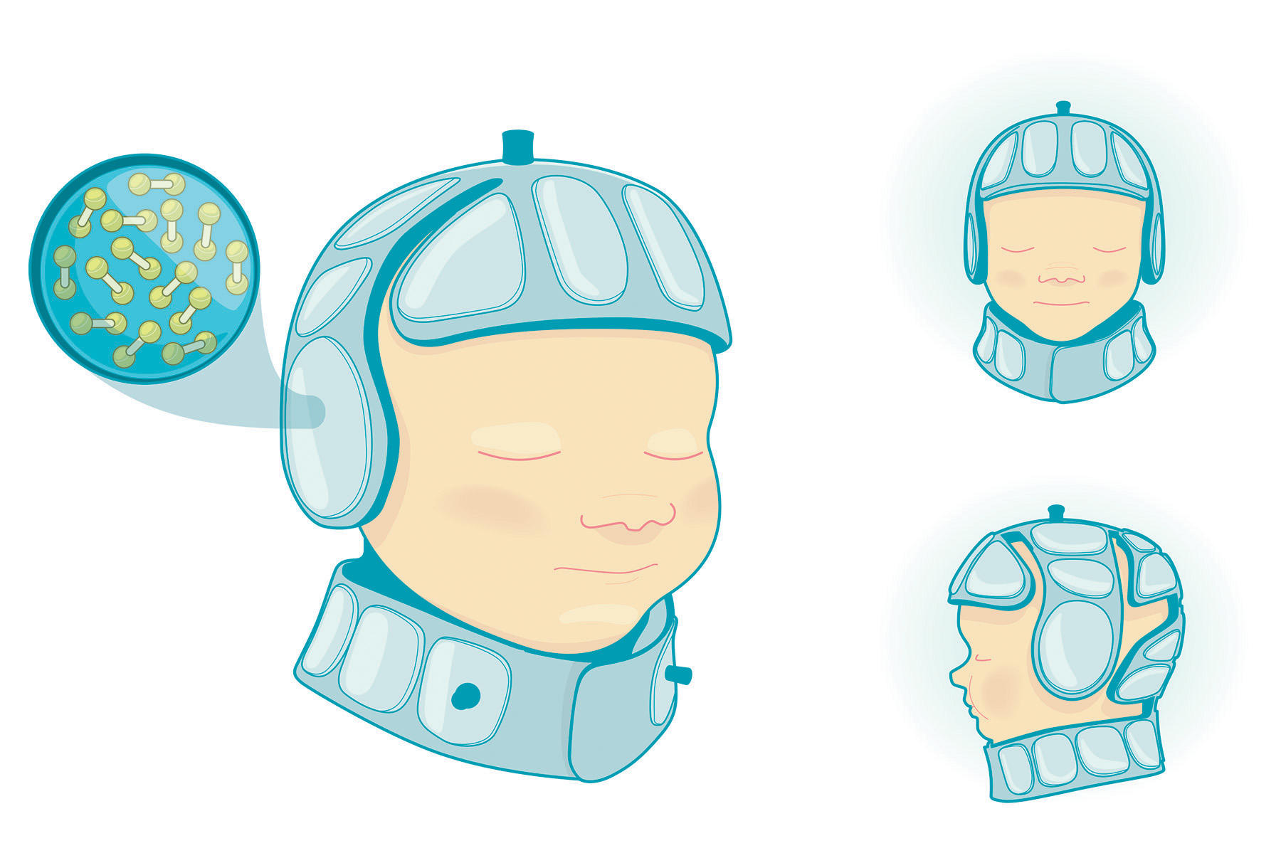 Baby helmet